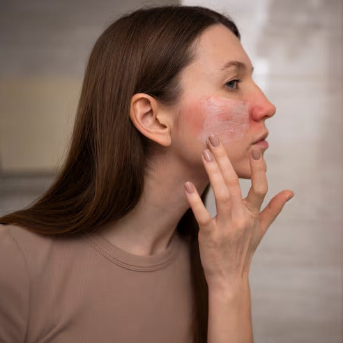 You have sensitive skin